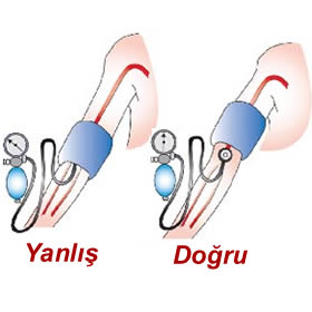 Tansiyon Nasıl Ölçülür? Tansiyon Nasıl Ölçülür?